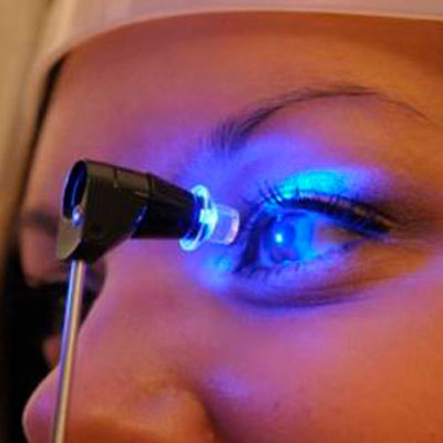4-presionintraocular